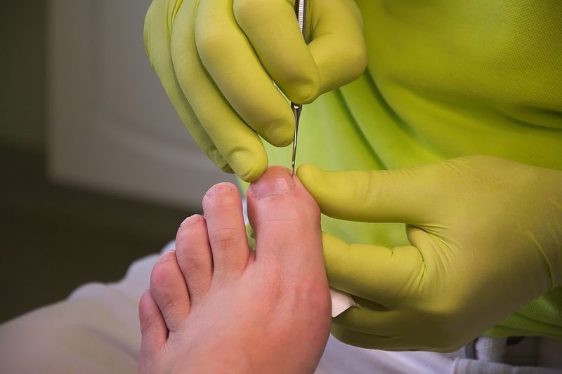 Le podologue, lui se concentre plus sur les pathologies des pieds